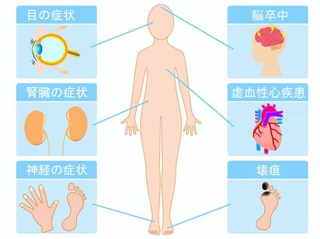 糖尿病とは？