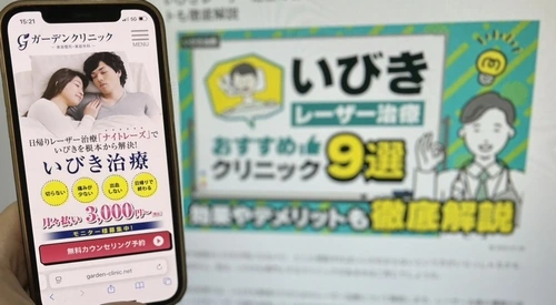 ガーデンクリニックのいびきレーザー治療