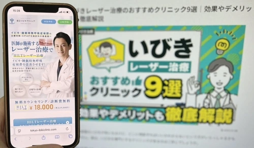 東京イビキクリニックのいびきレーザー治療